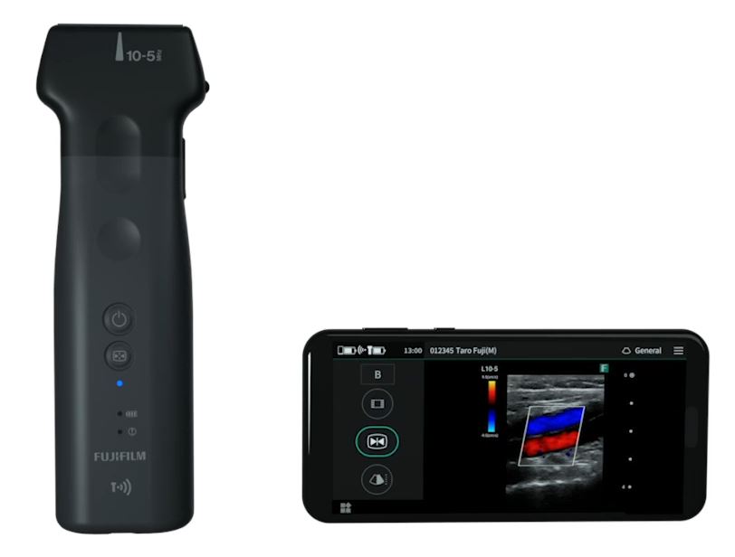 Ecografo palmare ULTRA portatile con sonda lineare o convex – Fujifilm –  Strumedical Shop
